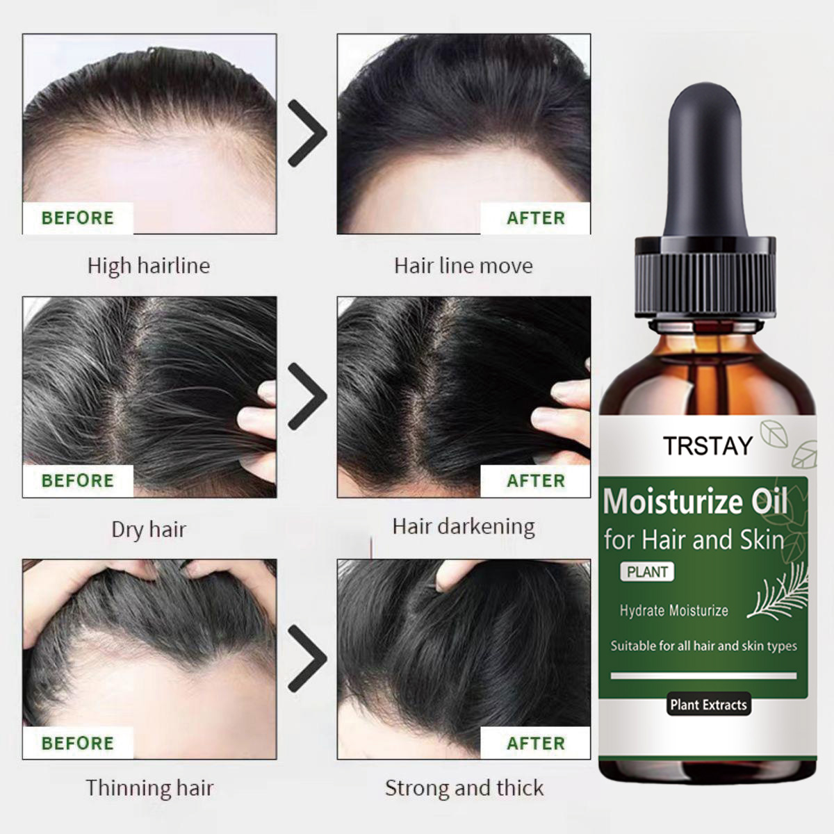 TRSTAY Rosemary Essential Oil  - Rosemary Hair Oil 评论和价格