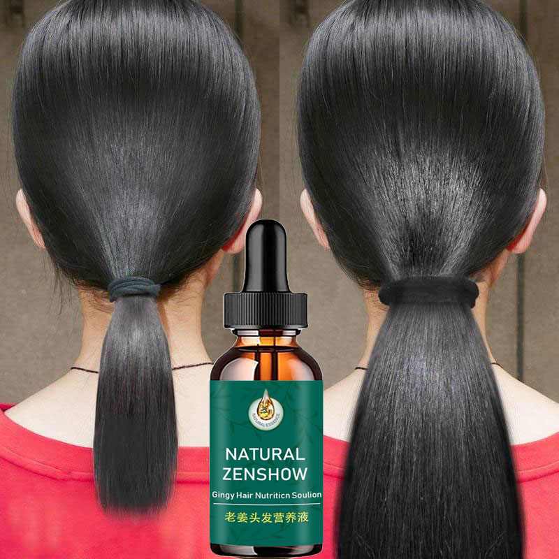 Ginger Hair Growth Essential O - Hair Care Herbal 评论和价格