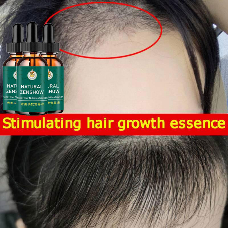 Ginger Hair Growth Essential O - Hair Care Herbal 评论和价格