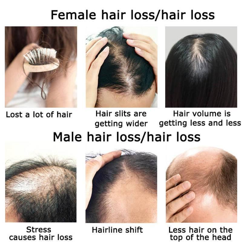 Ginger Hair Growth Essential O - Hair Care Herbal 评论和价格