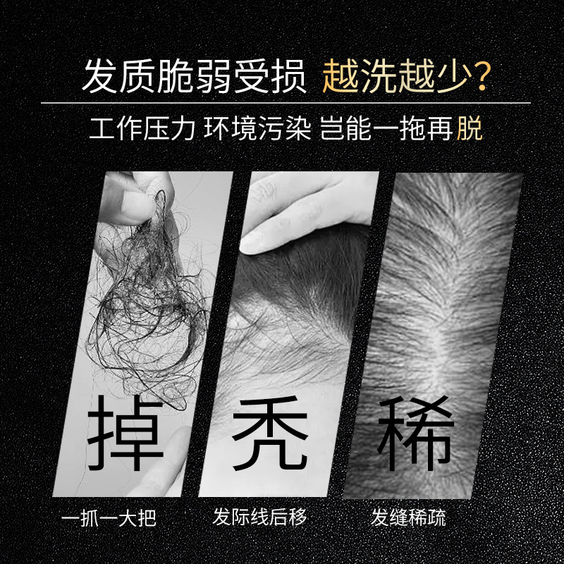 Famulan Anti Hair Loss Shampoo - Hair Care Normal 评论和价格