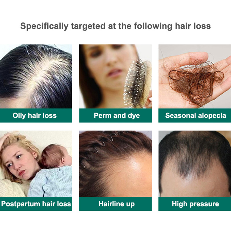 Hair Shedding Proof Shampoo 36 - Hair Care Herbal 评论和价格