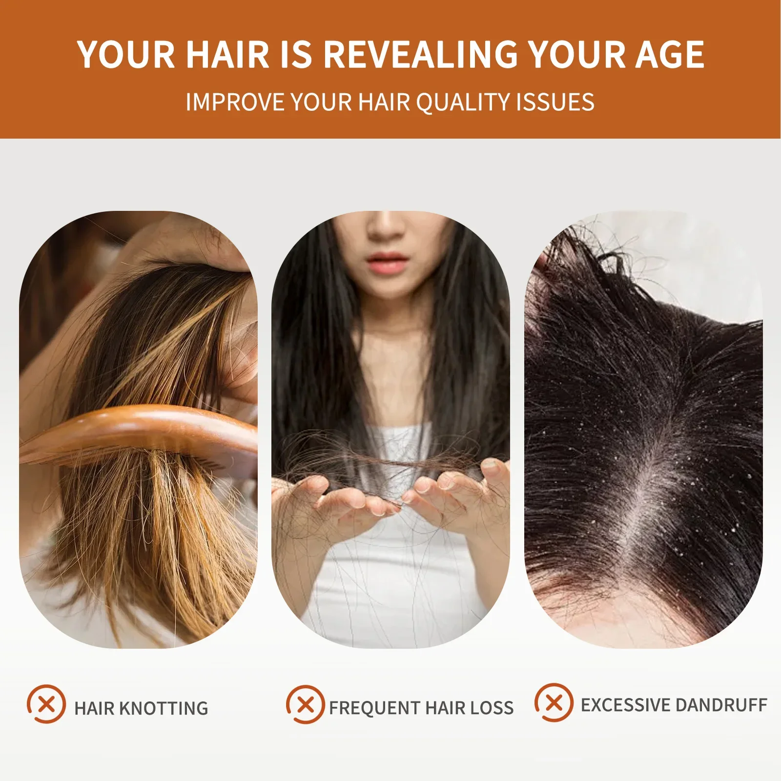 4 Bars of Anti-Hair Loss Shamp - Rosemary Hair Oil 评论和价格